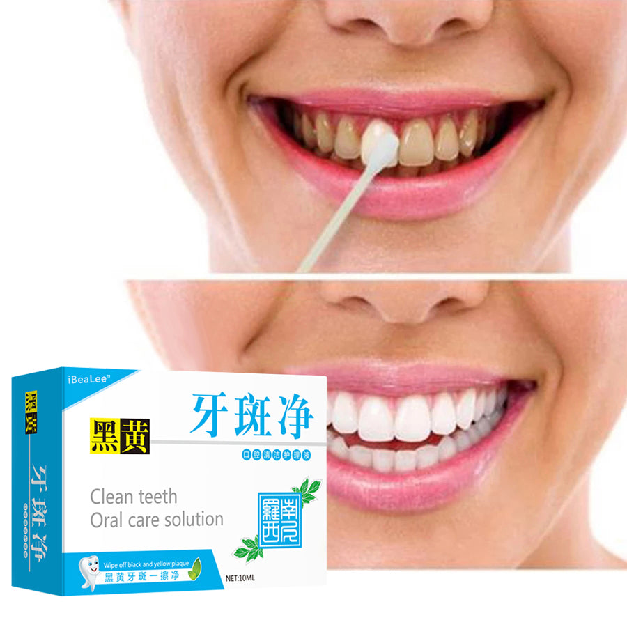 Teeth Whitening Quickly Remove Tooth Smoke Stains