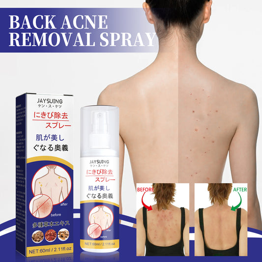 Back Care Spray Smallpox Diluting Back Acne Cleaning Repair