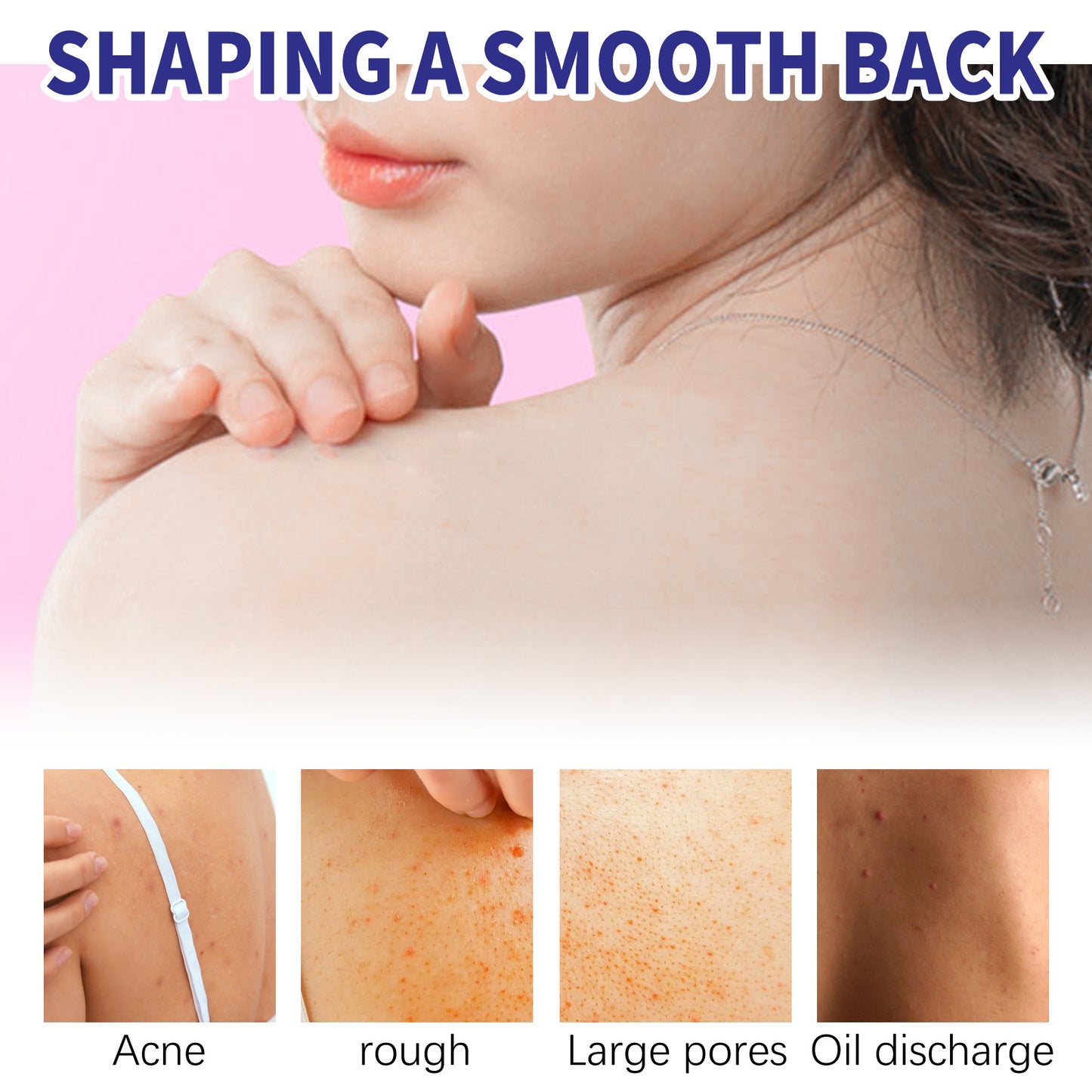 Back Care Spray Smallpox Diluting Back Acne Cleaning Repair