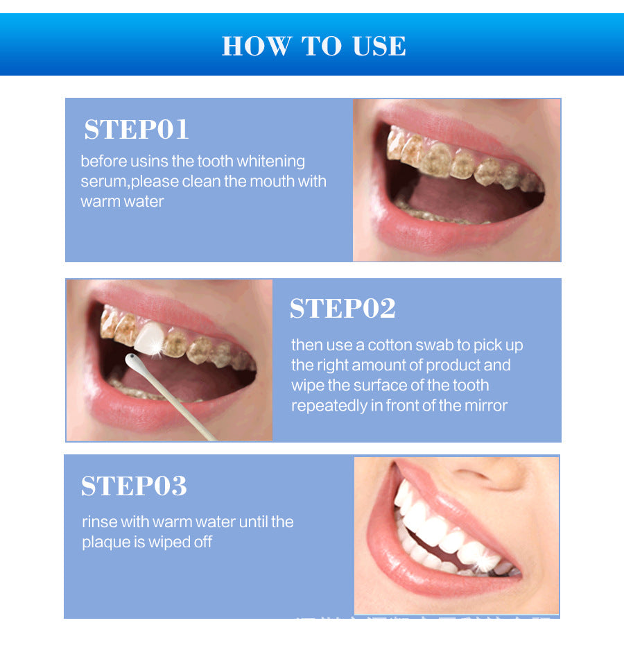 Teeth Whitening Quickly Remove Tooth Smoke Stains