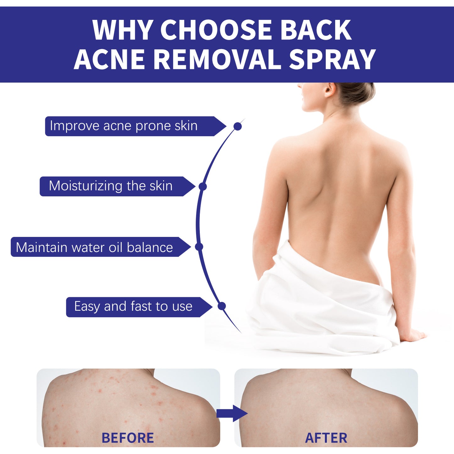 Back Care Spray Smallpox Diluting Back Acne Cleaning Repair