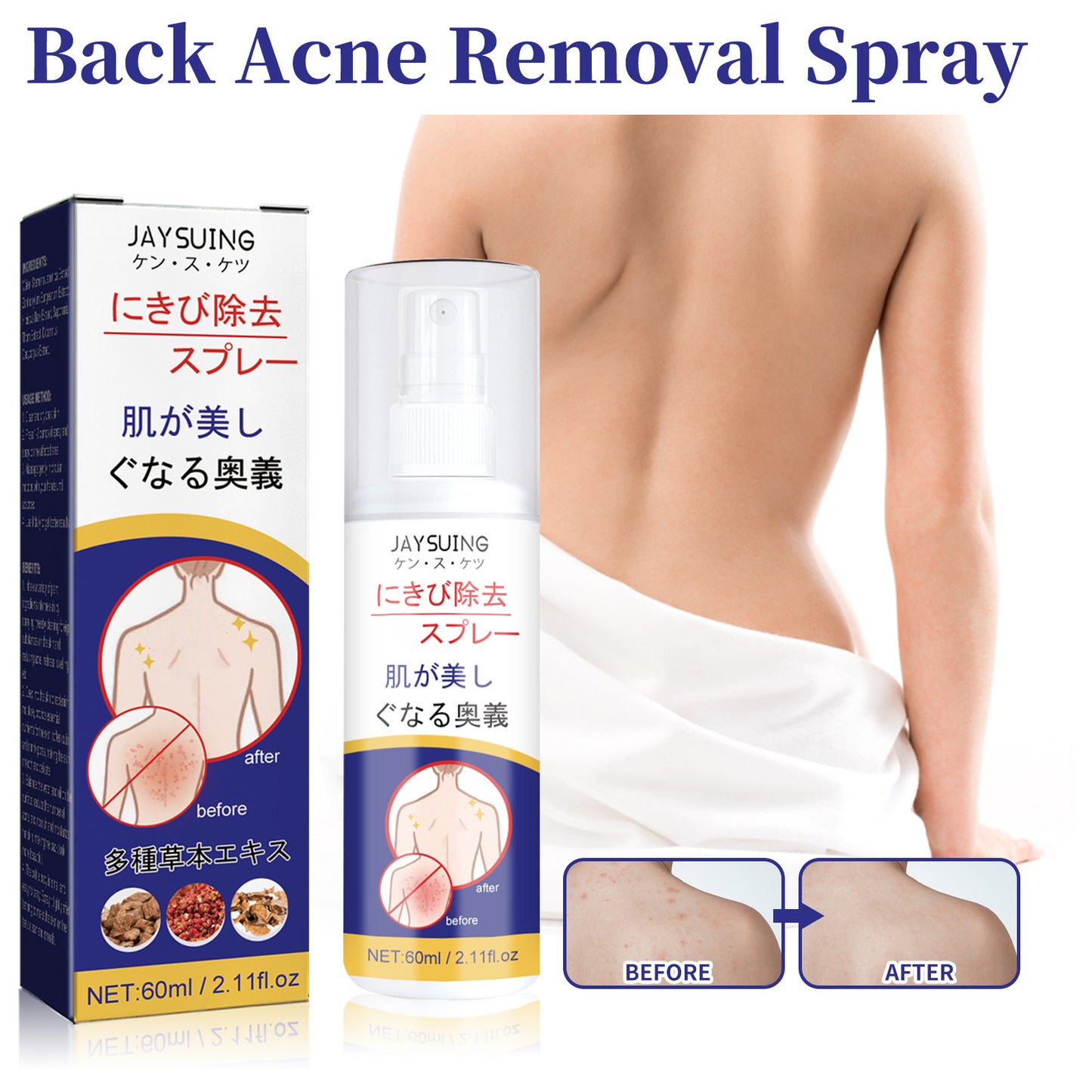 Back Care Spray Smallpox Diluting Back Acne Cleaning Repair