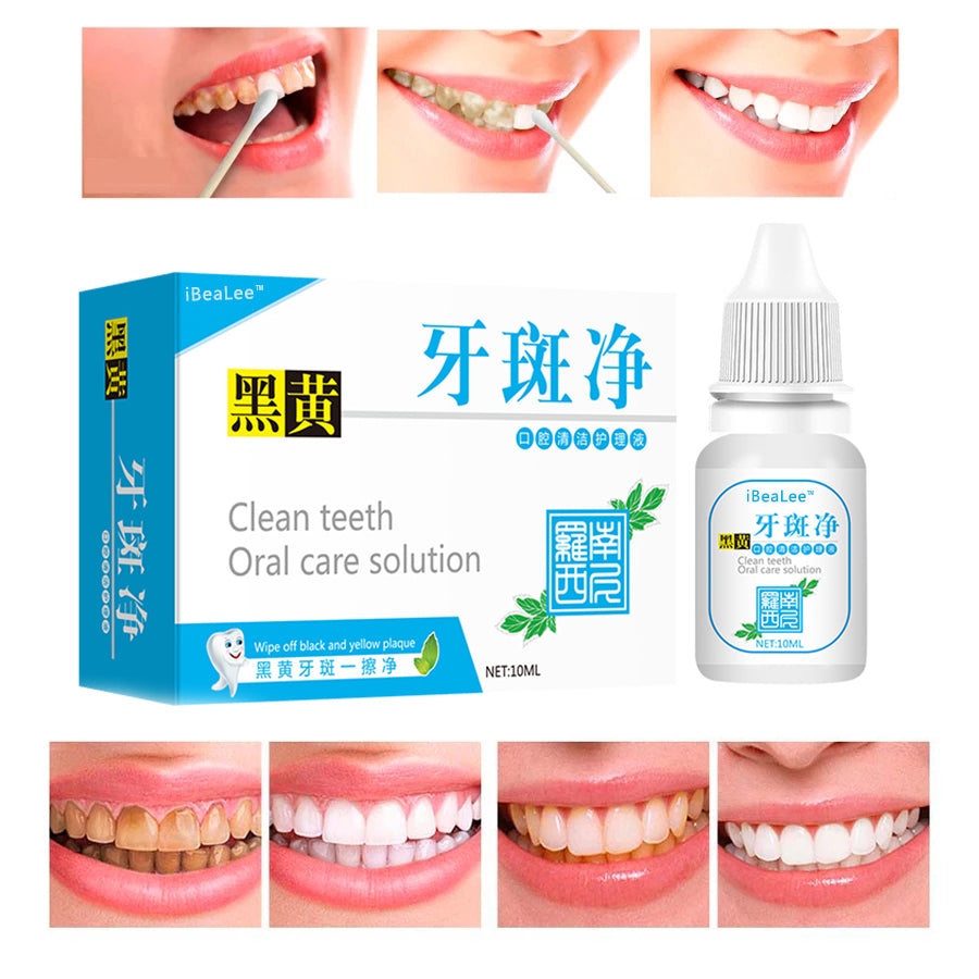 Teeth Whitening Quickly Remove Tooth Smoke Stains